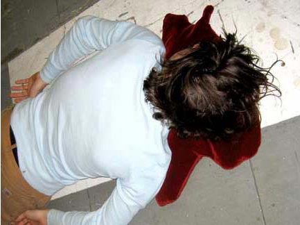 ��(chu��ng  )���OӋ��Ѫ���^��ɢѪ��